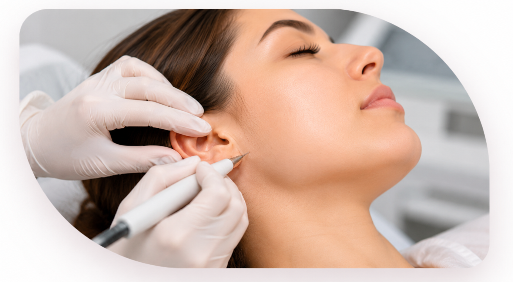 Electrolysis treatment being done gently by a trained specialist
